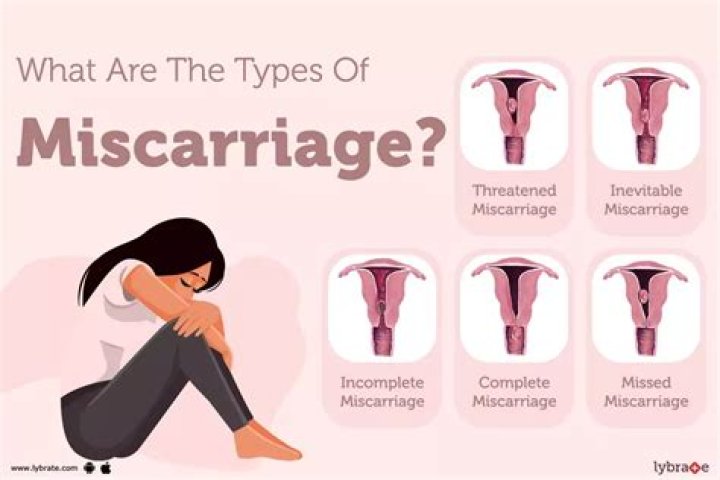 How common is it to miscarry after seeing heartbeat?