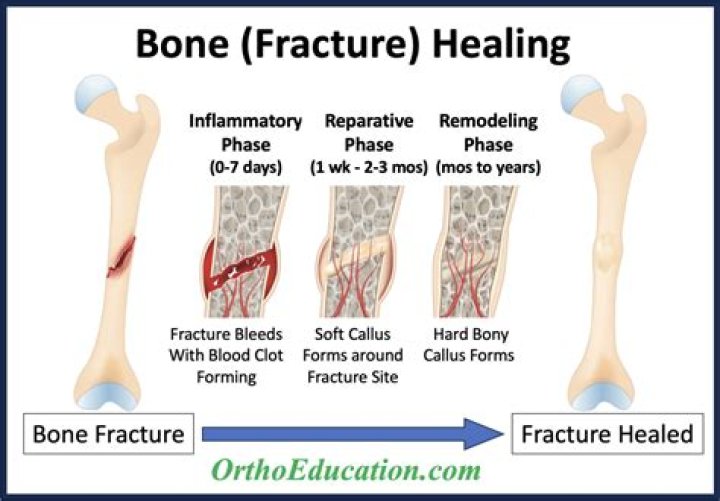 How do you heal a 4th degree tear?