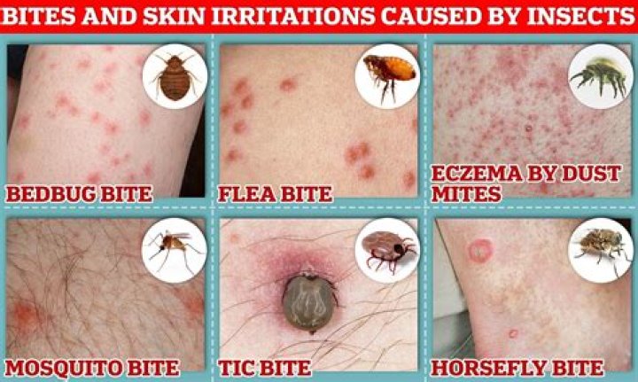 How do you keep bugs off your skin?