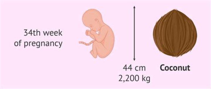 How Much Should twins weigh at 34 weeks?