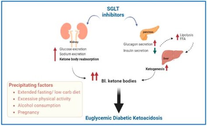 Is sodium high or low in DKA?