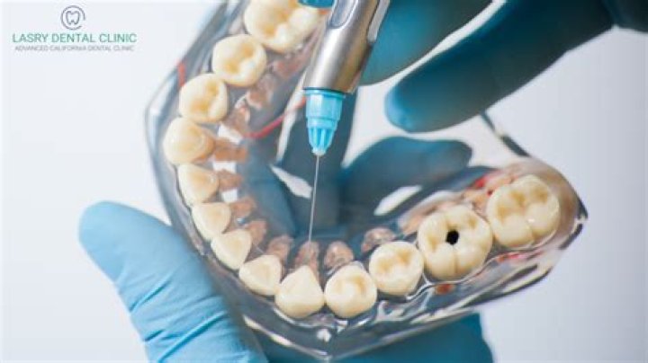 Which dental anesthetics are esters?