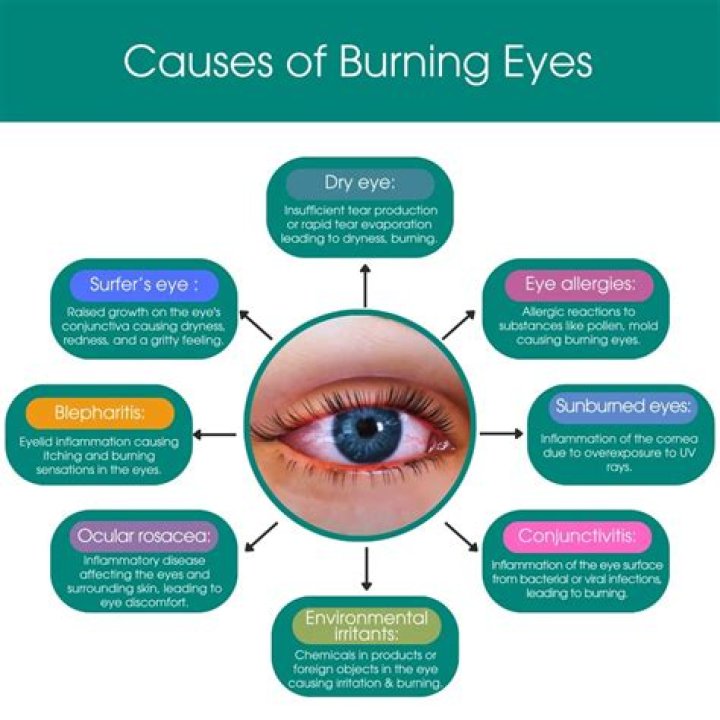 Why do my eyes burn in sunlight?